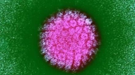 Ein Papillomavirus unter dem Elektronenmikroskop.
