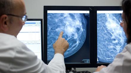 Ein Radiologe untersucht eine weibliche Brust auf einem Computermonitor.