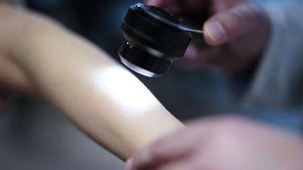 Ein Hautarzt untersucht bei einer Krebsvorsorgeuntersuchung eine Patientin mit einem Auflichtmikroskop. 