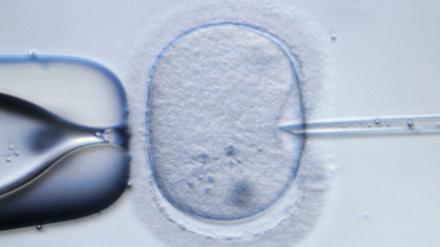 In Großbritannien sollen Forscher künftig das Erbgut menschlicher Embryonen gezielt verändern dürfen.
