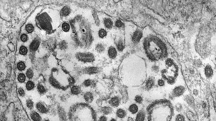 Im Transmissionselektronenmikroskopie sind die zahlreichen Marburg-Viren in dieser Zelle als runde, dunkelgraue Strukturen erkennbar.