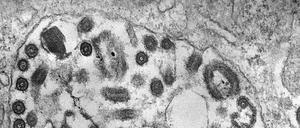 Im Transmissionselektronenmikroskopie sind die zahlreichen Marburg-Viren in dieser Zelle als runde, dunkelgraue Strukturen erkennbar.