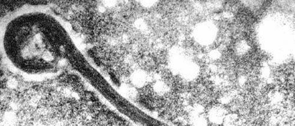 Wie Ebola gehört auch das Marburg-Virus zu den fadenförmigen Filoviren. 