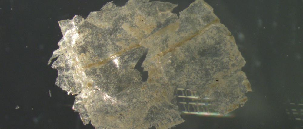 In jeder einzelnen der entnommenen Sedimentproben wiesen die Wissenschaftler:innen Mikroplastik-Teilchen nach – pro Kilogramm Sediment zwischen 215 und 1596 Partikel. 