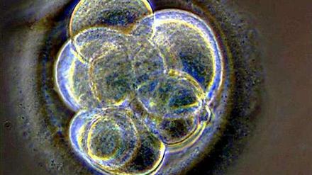 Wenn dem frühen Stadium eines Embryos, der aufgrund eines Gendefekts keine Niere bilden kann, genetisch intakte Stammzellen untergeschoben werden, dann können die Stammzellen dieses Organ bilden. So könnten in Tieren Organe aus menschlichen Zellen gezüchtet werden.