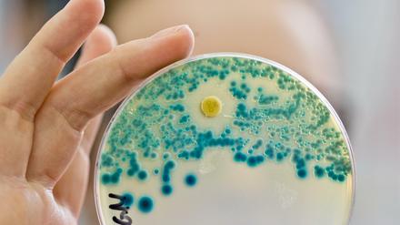 Resistent. Die Weltgesundheitsorganisation WHO will den Kampf gegen antibiotika-resistente Bakterien verstärken.