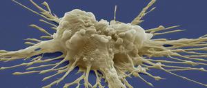 Eine pluripotente Stammzelle. Mit deren Entdeckung ist das "therapeutische Klonen" aus dem Blickfeld geraten.