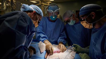 Einem US-Chirurgenteam ist laut Berichten der New York Times die Transplantation einer Schweineniere gelungen.