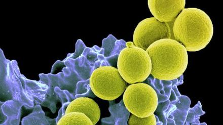 Resistent, aber nicht unbesiegbar: Staphylococcus-aureus-Bakterien, die gegen das Antibiotikum Methicillin resistent sind (gelb) werden von einer Immunzelle (blau-violett) verschluckt.