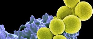 Resistent, aber nicht unbesiegbar: Staphylococcus-aureus-Bakterien, die gegen das Antibiotikum Methicillin resistent sind (gelb) werden von einer Immunzelle (blau-violett) verschluckt.
