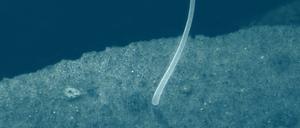 Das größte (bekannte) Bakterium der Welt: Thiomargarita magnifica.