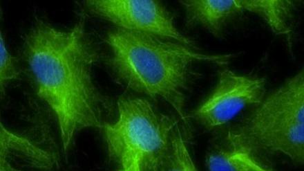 Im Thymusgewebe (hier grün gefärbte Thymuszellen, mit blau gefärbten Zellkernen) lernen die T-Zellen des Immunsystems, welche Strukturen körpereigen sind und nicht angegriffen werden sollen - bei Multipler Sklerose funktioniert das nicht mehr.