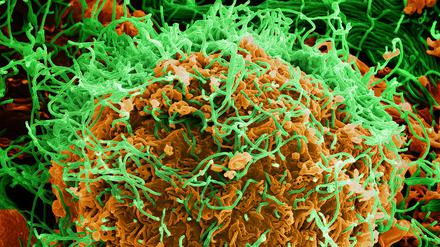 Angefärbte elektronenmikroskopische Aufnahme von Ebola-Virenkörpern, die sich von einer befallenen Zelle lösen.