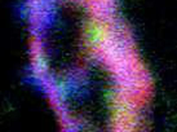 Von einem anderen Stern? Röntgenfluoreszenz-Aufnahme eines Körnchens, das mutmaßlich aus dem interstellaren Raum kommt. Die rote Färbung zeigt Aluminium an, grün für Eisen, blau für Magnesium. 