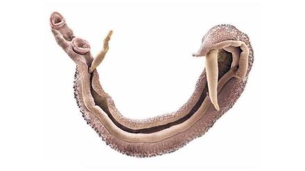 Ein Pärchen Pärchen-Egel. Das Männchen bildet eine Rinne, in die sich das längere, dünnere Weibchen verkriecht. In dieser Form können die Parasiten Jahrzehnte im Blut des Menschen überdauern.