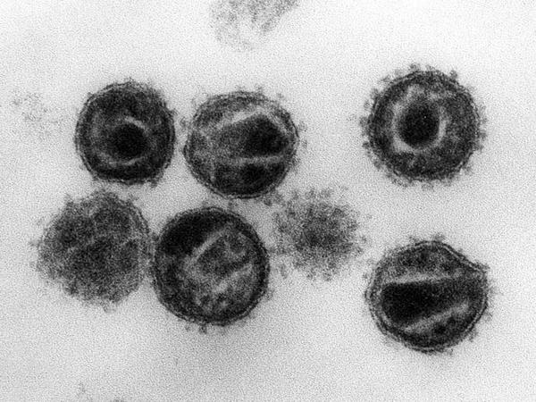 Im Bild eine elektronenmikroskopische Aufnahme mehrerer HI-Viren, Erreger der Immunschwäche-Krankheit Aids. 